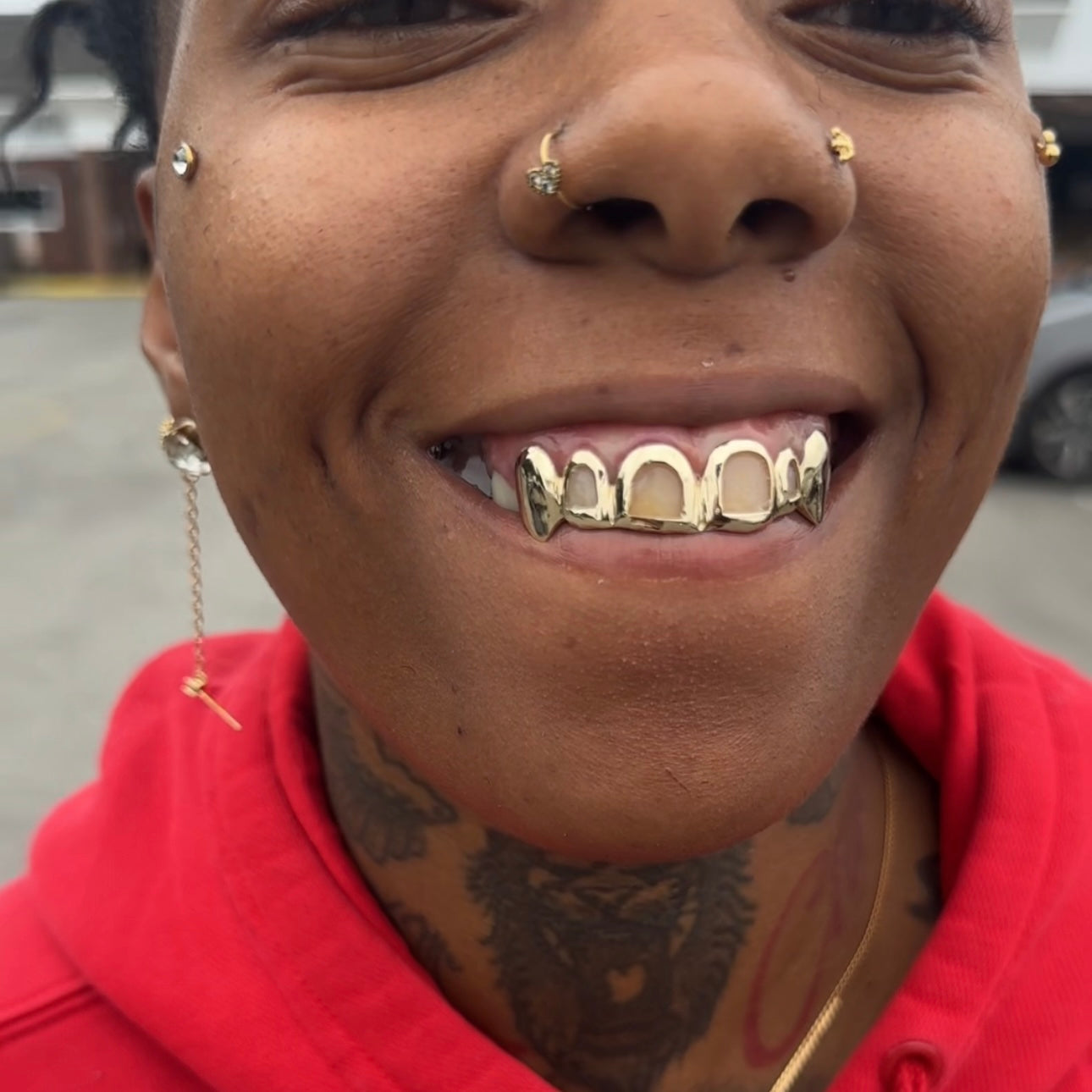 Custom GOLD Grillz DEPOSIT/Consultation - Final Price Depends on STYLE