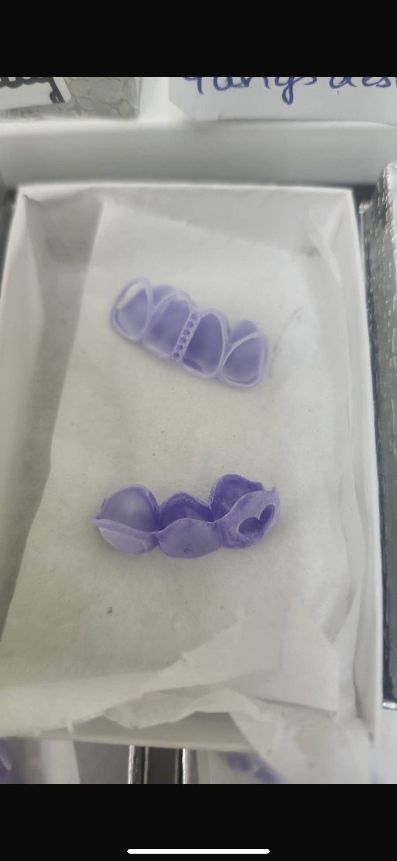 Custom GOLD Grillz DEPOSIT/Consultation - Final Price Depends on STYLE