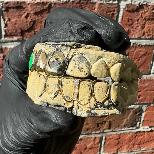 Custom GOLD Grillz DEPOSIT/Consultation - Final Price Depends on STYLE