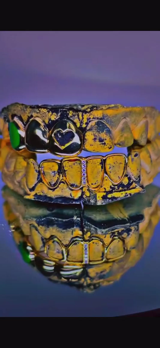 Custom GOLD Grillz DEPOSIT/Consultation - Final Price Depends on STYLE